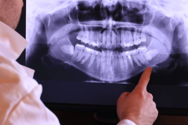 Best Emergency Dental Care for Sports Injuries in Culver, OR