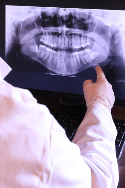 Best Emergency Denture Repair in Culver, OR